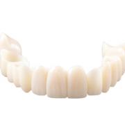 CAD/CAM Oral-Temp Provisionals