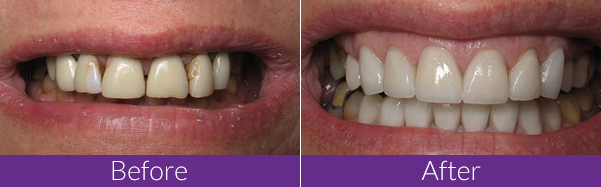 Dr Echols Dentist Cullman Al - Cullman Cosmetic & Family Dentistry - Home | Facebook - For new and existing patients, please see recommendations on how to schedule an appointment with dr.