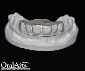 How Much Are Dentures >> BiteSoft® | Oral Arts Dental Laboratories - Huntsville, AL How Much Are Dentures >> BiteSoft® | Oral Arts Dental Laboratories - Huntsville, AL